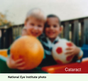 hazy image of two boys holding a ball, simulating how someone with cataracts sees