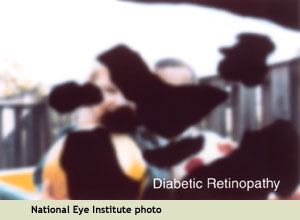 NEI example of seeing with diabetic retinopathy: many blind spots and overall blurriness