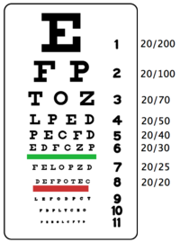 eye prescription 200