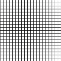 Amsler Grid as seen with normal vision