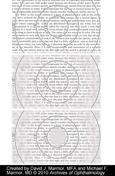 text in a book: top shows how camera would capture it (fully focused), middle shows how a person with full vision would see it (clear in the center of visual field, where the person is focusing), and how a person with age-related macular degneration would see it (blurry on the edges but also in the very middle)