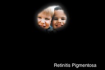 A scene as it might be viewed by a person with retinitis pigmentosa