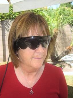 Close-up of Kathy wearing the Argus II glasses