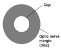 A graphic representation of the cup and disc of the optic nerve head. Source: Author