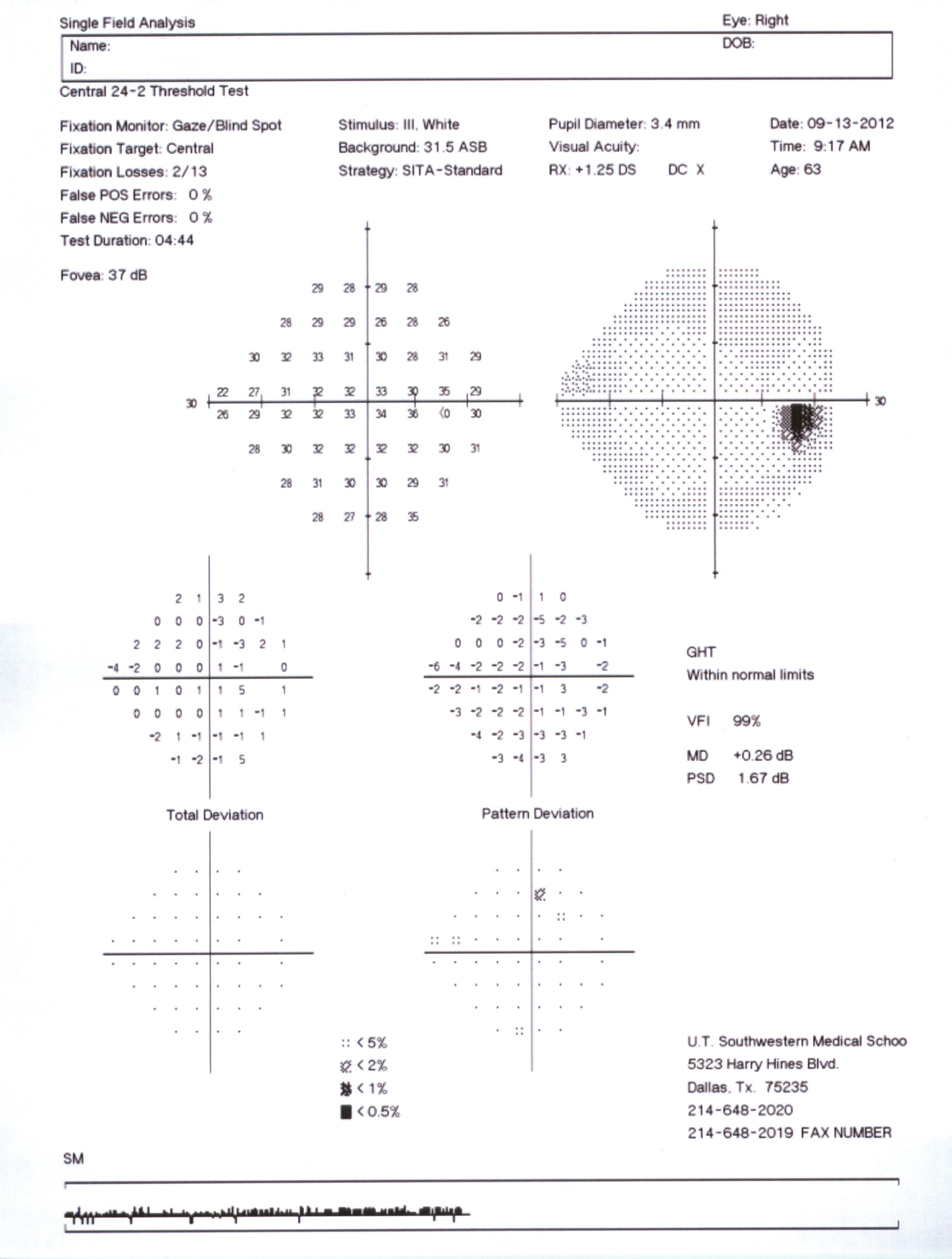 Map of a normal visual field. Source: Courtesy Karanjit Kooner MD and William Anderson, photographer, University of Texas Southwestern Medical Center, Dallas.