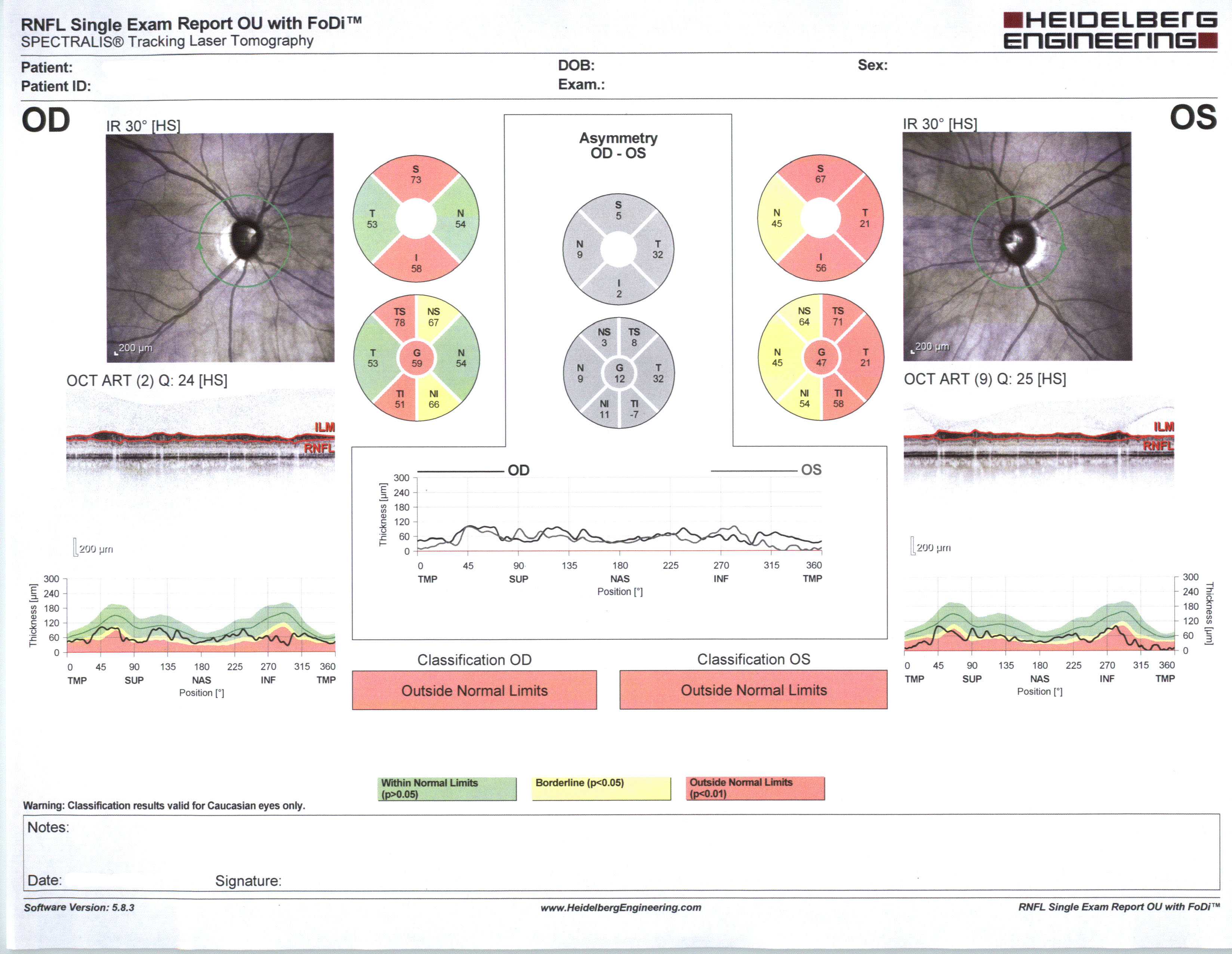 Nerve fiber layer analysis in glaucoma. Source: Courtesy Karanjit Kooner MD and William Anderson, photographer, University of Texas Southwestern Medical Center, Dallas.