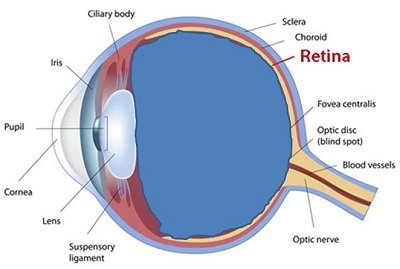 view of the eye with vitreous