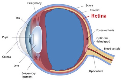 view of the eye with posterior vitreous detachment