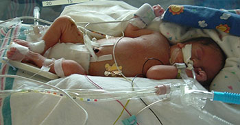 JD at birth in a crib at the hospital