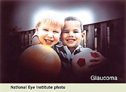 NEI photo simulating what a person with glaucoma sees: outer edges of vision are dark